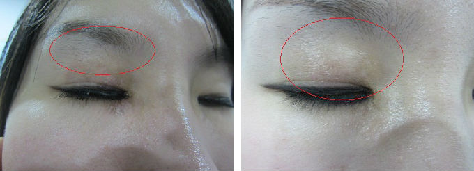 武汉白癜风医院